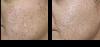 Aanya Skin Clinic  -