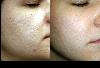 Aanya Skin Clinic  -
