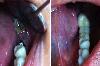 Dhanwanth Dental Care -